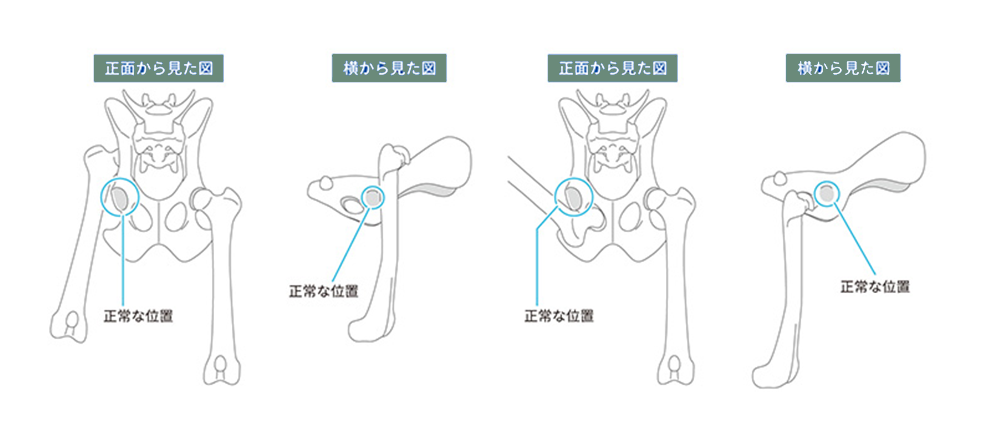 犬の股関節脱臼